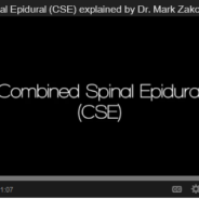 Combined Spinal Epidural (CSE)